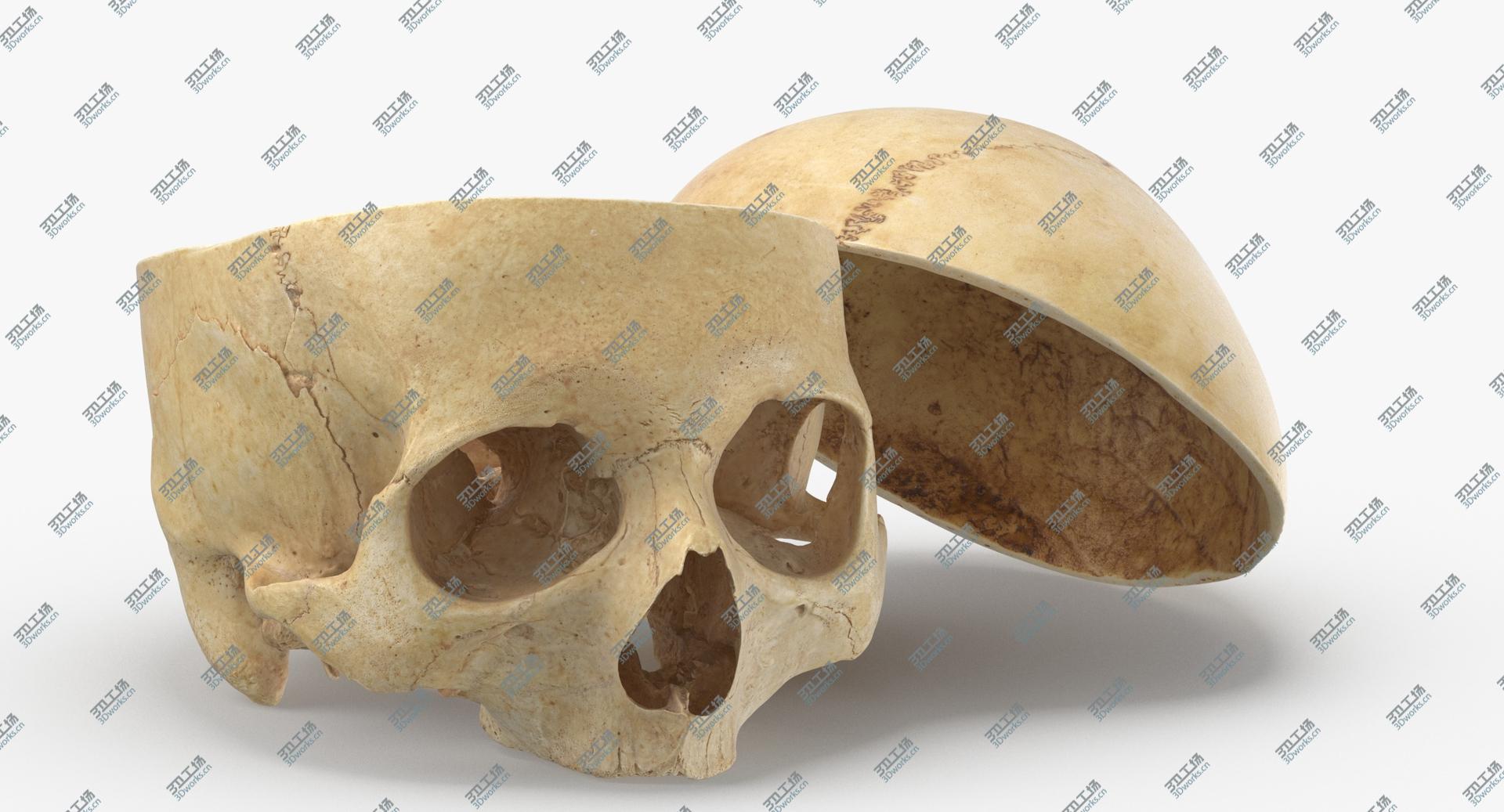 images/goods_img/202104091/Real Human Skull Cranial 02 Cut With Piece Pose 02 model/2.jpg